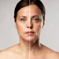 According to studies about this procedure with proper skin care routine, the results can be maintained for up to a year (Image by Freepik)
